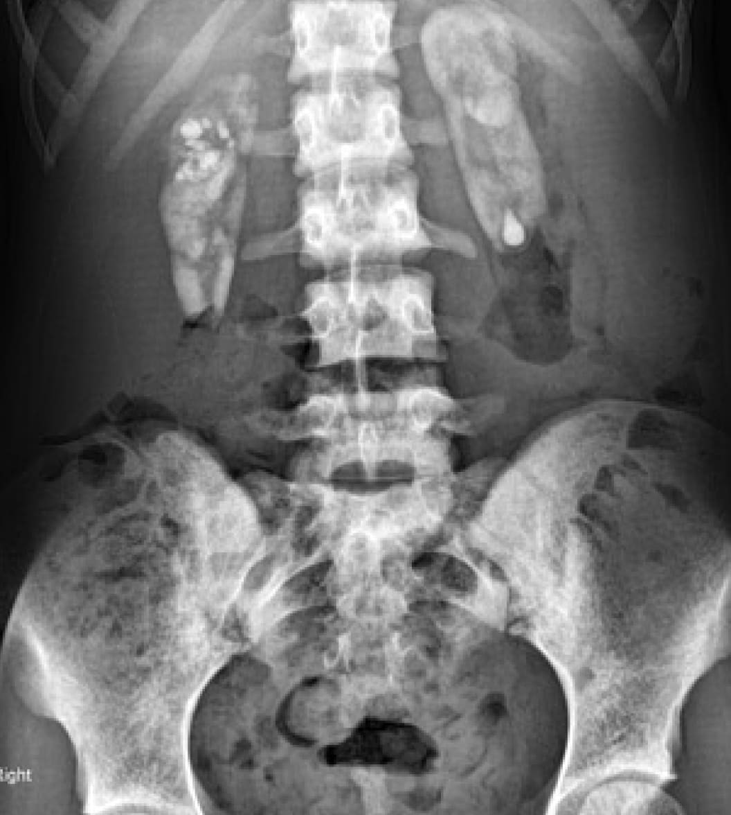 X-Ray