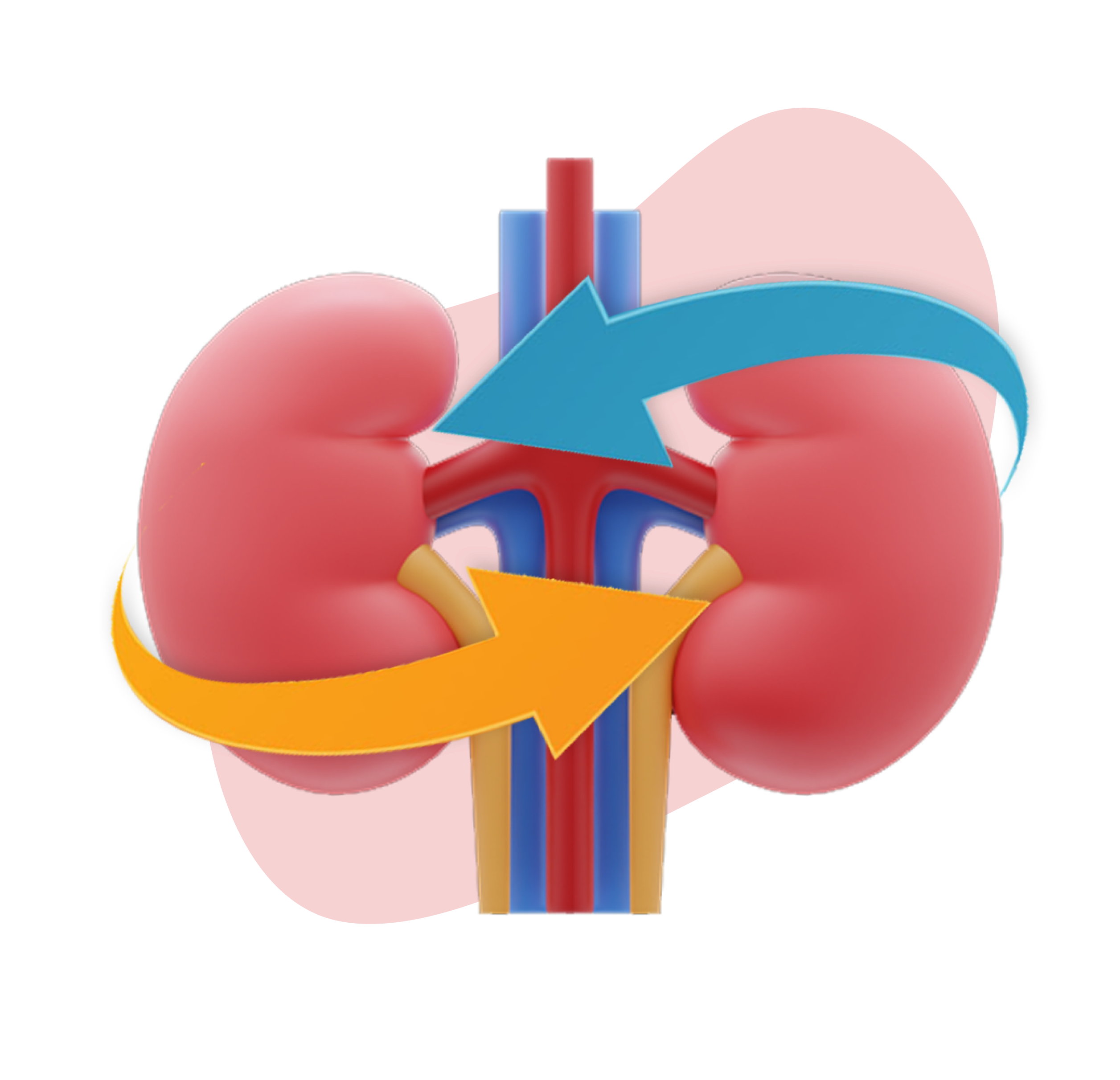 Shashtha kidney transplantation
